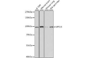 Western blot analysis of extracts of various cell lines, using VPS16 antibody (ABIN7271281) at 1:1000 dilution.