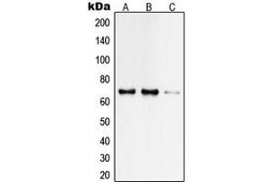 Western blot analysis of TAF6L expression in HeLa (A), Jurkat (B), rat brain (C) whole cell lysates.