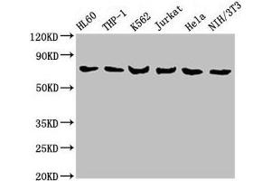 Western Blot Positive WB detected in: HL60 whole cell lysate, THP-1 whole cell lysate, K562 whole cell lysate, Jurkat whole cell lysate, Hela whole cell lysate, NIH/3T3 whole cell lysate All lanes: LCP1 antibody at 8 μg/mL Secondary Goat polyclonal to rabbit IgG at 1/10000 dilution Predicted band size: 71, 22 kDa Observed band size: 71 kDa (LCP1 anticorps  (AA 2-627))