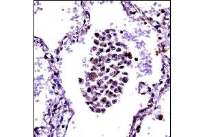 NFKBIB Antibody (C-term) ((ABIN657702 and ABIN2846693))immunohistochemistry analysis in formalin fixed and paraffin embedded human lung tissue followed by peroxidase conjugation of the secondary antibody and DAB staining. (NFKBIB anticorps  (C-Term))