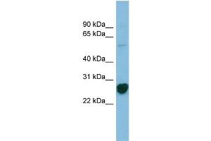 WB Suggested Anti-RPL10A Antibody Titration: 0. (RPL10A anticorps  (N-Term))