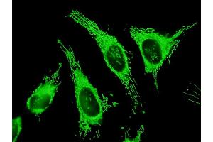 Immunofluorescence of purified MaxPab antibody to TRAP1 on HeLa cell.