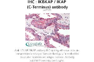 Image no. 2 for anti-Elongator Complex Protein 1 (ELP1) antibody (ABIN1735852) (IKAP/p150 anticorps)