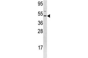 Western blot analysis of FLI1 antibody and 293 lysate. (FLI1 anticorps  (AA 52-80))