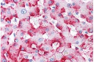 Human Liver (formalin-fixed, paraffin-embedded) stained with C4BPA antibody ABIN334259 at 5 ug/ml followed by biotinylated anti-mouse IgG secondary antibody ABIN481714, alkaline phosphatase-streptavidin and chromogen. (C4BP anticorps)