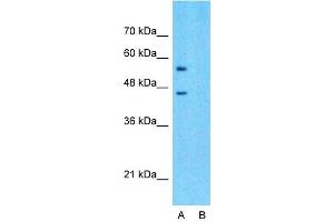 Host:  Rabbit  Target Name:  SLC15A4  Sample Type:  293T  Lane A:  Primary Antibody  Lane B:  Primary Antibody + Blocking Peptide  Primary Antibody Concentration:  1ug/ml  Peptide Concentration:  5ug/ml  Lysate Quantity:  25ug/lane/lane  Gel Concentration:  0.