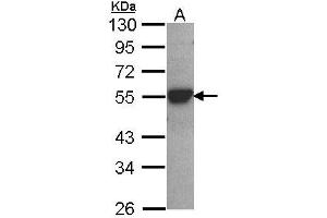 Image no. 2 for anti-Cytochrome P450, Family 2, Subfamily D, Polypeptide 6 (CYP2D6) (AA 268-457) antibody (ABIN467616) (CYP2D6 anticorps  (AA 268-457))