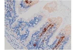 ABIN6267438 at 1/200 staining Mouse intestinal tissue sections by IHC-P.