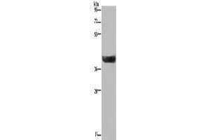 Western Blotting (WB) image for anti-Hydroxysteroid (17-Beta) Dehydrogenase 2 (HSD17B2) antibody (ABIN2423607) (HSD17B2 anticorps)