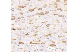 Immunohistochemistry analysis of paraffin-embedded mouse brain using,KCNG3 (ABIN7075157) at dilution of 1: 2000 (KCNG3 anticorps)