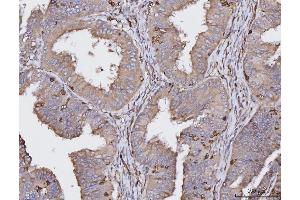 IHC analysis of HLA-DRA using anti-HLA-DRA antibody (ABIN7600949).