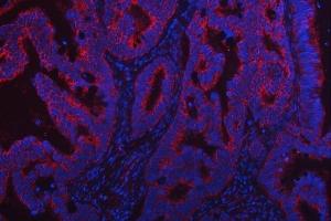 IF analysis of TRMT2B using anti-TRMT2B antibody (ABIN7599456). (TRMT2B anticorps  (AA 1-504))