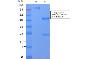 SDS-PAGE Analysis Purified CD59 Rabbit Recombinant Monoclonal Antibody (MACIF/2867R).