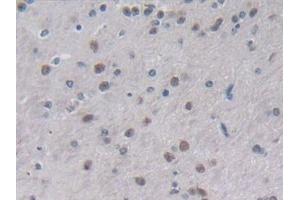 Detection of IL2 in Mouse Cerebrum Tissue using Polyclonal Antibody to Interleukin 2 (IL2) (IL-2 anticorps  (AA 10-169))