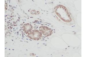 Image no. 1 for anti-Cardiotrophin 1 (CTF1) antibody (ABIN465486) (Cardiotrophin 1 anticorps)