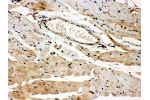 IHC testing of FFPE mouse heart with ROCK2 antibody. (ROCK2 anticorps  (AA 652-923))