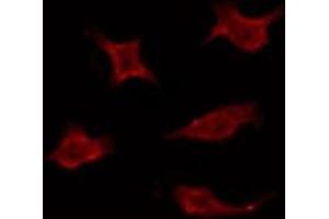 ABIN6275935 staining Hela by IF/ICC. (LPAR3 anticorps  (Internal Region))