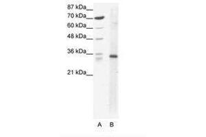 Image no. 1 for anti-Kruppel-Like Factor 3 (Basic) (KLF3) (AA 53-102) antibody (ABIN202293) (KLF3 anticorps  (AA 53-102))