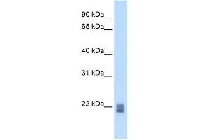 WB Suggested Anti-Rgs1 Antibody Titration:  5.