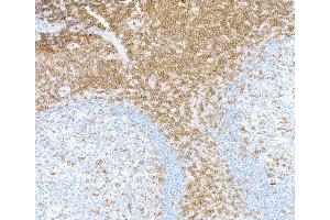 Immunohistochemistry (IHC) image for anti-CD3 epsilon (CD3E) (AA 139-189) antibody (ABIN7454000) (Recombinant CD3 epsilon anticorps  (AA 139-189))
