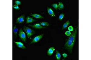 Immunofluorescent analysis of A549 cells using ABIN7151925 at dilution of 1:100 and Alexa Fluor 488-congugated AffiniPure Goat Anti-Rabbit IgG(H+L) (EMP1 anticorps  (AA 22-66))