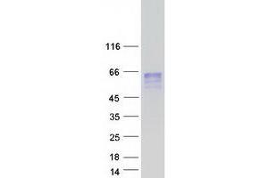 Validation with Western Blot