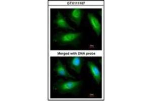 Immunofluorescence analysis of paraformaldehyde-fixed HeLa, using actinin, alpha 2 antibody at 1/200 dilution. (ACTN2 anticorps)