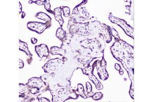 IHC analysis of cortactin using anti-cortactin antibody (ABIN6719306). (Cortactin anticorps  (AA 1-105))