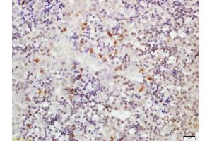 Formalin-fixed and paraffin embedded fetal mouse liver labeled with Rabbit Anti-RLBP1L1 Polyclonal Antibody, Unconjugated  at 1:200 followed by conjugation to the secondary antibody and DAB staining (Clavesin 1 anticorps  (AA 231-330))