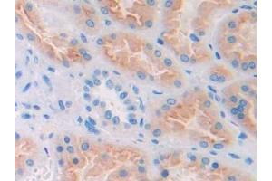 Used in DAB staining on fromalin fixed paraffin- embedded kidney tissue (CUBN anticorps  (AA 3511-3623))