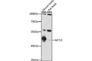 Western blot analysis of extracts of various cell lines, using  antibody (ABIN7265389) at 1:1000 dilution. (ACTL9 anticorps  (AA 1-416))