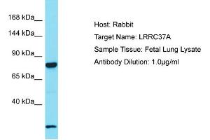 Host: Rabbit Target Name: LRRC37A2 Sample Tissue: Human Fetal Lung Antibody Dilution: 1ug/ml (LRRC37A anticorps  (C-Term))