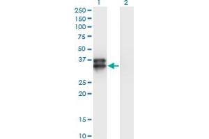 Western Blot analysis of OLIG2 expression in transfected 293T cell line by OLIG2 monoclonal antibody (M06), clone 2B11. (OLIG2 anticorps  (AA 2-78))