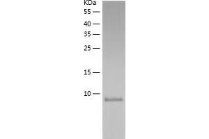 Western Blotting (WB) image for Thiosulfate Sulfurtransferase (Rhodanese)-Like Domain Containing 3 (TSTD3) (AA 1-97) protein (His tag) (ABIN7125372) (TSTD3 Protein (AA 1-97) (His tag))