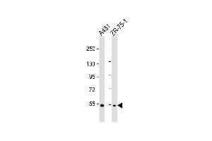 Western Blot at 1:1000 dilution Lane 1: A431 whole cell lysate Lane 2: ZR-75-1 whole cell lysate Lysates/proteins at 20 ug per lane. (MEFV anticorps  (AA 418-445))