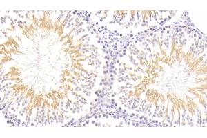 Detection of NFE2L2 in Rat Testis Tissue using Polyclonal Antibody to Nuclear Factor, Erythroid Derived 2 Like Protein 2 (NFE2L2)
