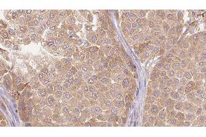 anti-Interleukin 27 (IL27) (Internal Region) antibody