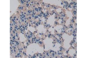 Used in DAB staining on fromalin fixed paraffin- embedded lung tissue (ALOX12B anticorps  (AA 389-701))