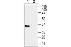 Western blot analysis of human MDA- breast adenocarcinoma cell line lysate:1. (Pyrimidinergic Receptor P2Y, G-Protein Coupled, 6 (P2RY6) Peptide)