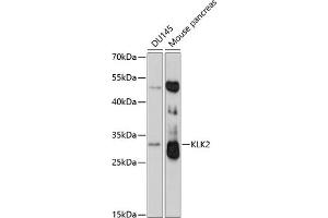Western blot analysis of extracts of various cell lines, using KLK2 antibody (ABIN3017126, ABIN3017127, ABIN1680612 and ABIN6219970) at 1:3000 dilution. (Kallikrein 2 anticorps  (AA 25-250))