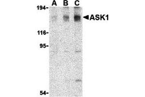Western Blotting (WB) image for anti-Mitogen-Activated Protein Kinase Kinase Kinase 5 (MAP3K5) antibody (ABIN1030199) (ASK1 anticorps)