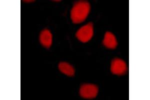 ABIN6269102 staining MCF-7 cells by ICC/IF.