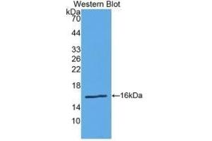 Detection of Recombinant Renin, Human using Polyclonal Antibody to Renin (REN)