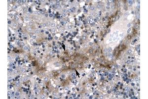 ZNF365 antibody was used for immunohistochemistry at a concentration of 4-8 ug/ml to stain Hepatocyte (arrows) in Human Liver. (ZNF365 anticorps  (N-Term))