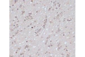 Immunohistochemistry of paraffin-embedded Rat brain using Phospho-BRCA1(S1423) Polyclonal Antibody at dilution of 1:100 (40x lens).
