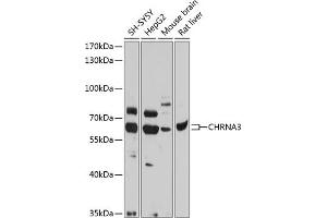 Western blot analysis of extracts of various cell lines, using CHRN antibody (ABIN6133178, ABIN6138575, ABIN6138576 and ABIN6218768) at 1:1000 dilution. (CHRNA3 anticorps  (AA 32-240))