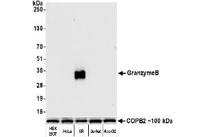 Western Blotting (WB) image for anti-Granzyme B (GZMB) (AA 19-247) antibody (ABIN7449554) (Recombinant GZMB anticorps  (AA 19-247))