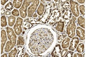 Immunohistochemical analysis of paraffin-embedded Human kidney section using Pink1 am1893b. (TGFB2 anticorps)