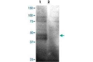 Western blot analysis of HEK293 cells over-expressing SLC2A1 (Lane 1) or a nono-specific control receptor (Lane 2) using SLC2A1 polyclonal antibody  at 1:200 dilution.