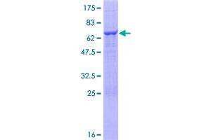 Image no. 1 for Tripartite Motif Containing 5 (TRIM5) (AA 1-347) protein (GST tag) (ABIN1323702)